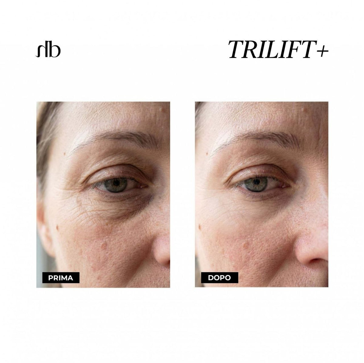 TRILIFT+ - 3-in-1 Augenpflege - 10ml